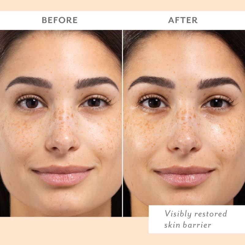 Skin Remedy Barrier- Boosting Sheet Mask (4 pack) - Image 3